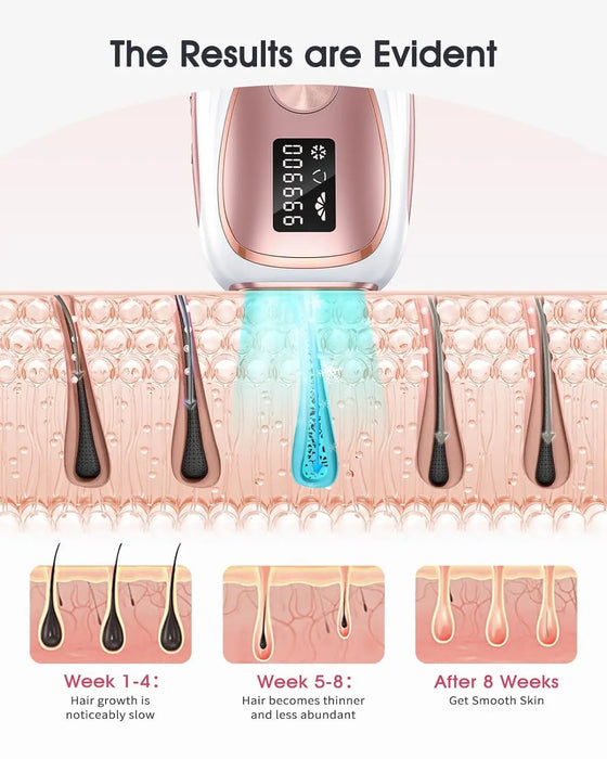IPL Hair Removal 999900 Flashes Ice Colding Painless Epilator Depilator Full Body Hair Remover For Men Women Home Use