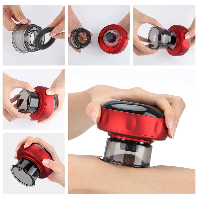 12 Speed Intelligent Vacuum Cupping Set