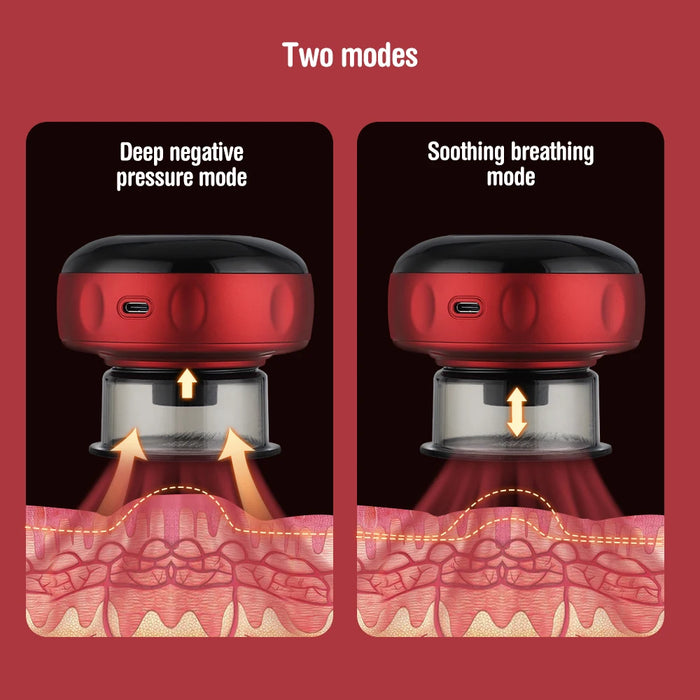 12 Speed Intelligent Vacuum Cupping Set