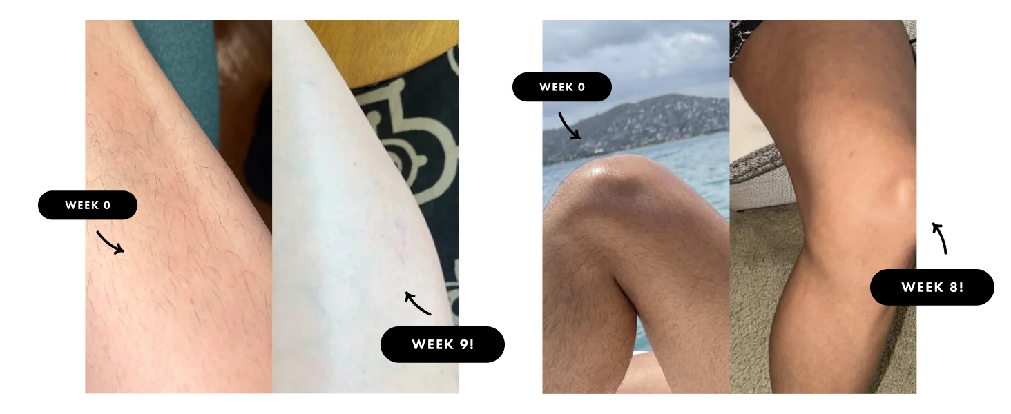 Professional IPL Hair Removal Laser 999900 Flashes Painless Pulsed Light Epilator HR/RA/SC 3 in 1 Whole Body Treament Home Use