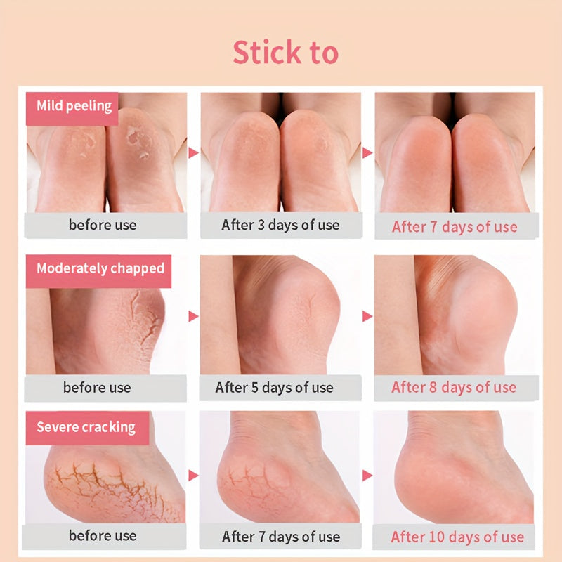 Silicone Moisturizing Heel Sleeves - 1 Pair For Women And Men, Exfoliates, Softens, And Supports Heels, Preventing Cracking